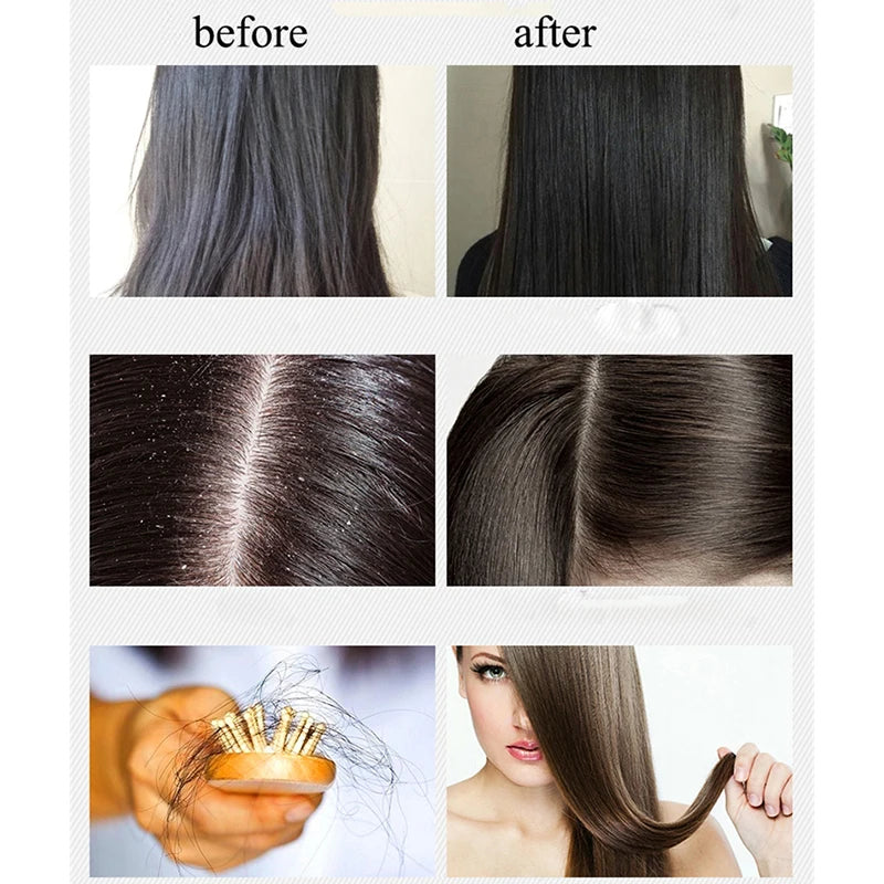 BOQIAN Professional Ginger Hair Shampoo 500ml Hair Conditioner Treatment 500ml Hair Care Set Moisturizing Clean Anti Hair Loss