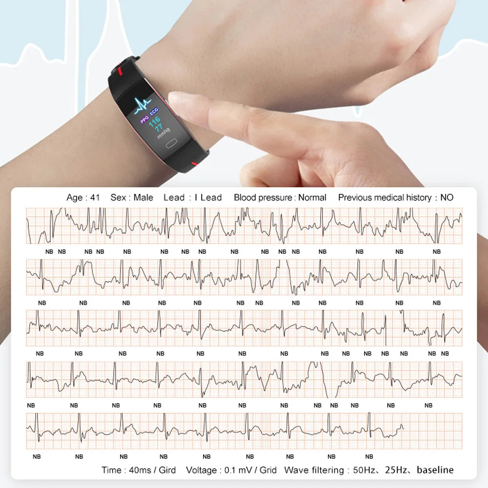 ECG+PPG Smart Bracelet Men Heart Rate Blood Pressure Oxygen Monitoring Healthy Smart Band IP67 Waterproof Sport Fitness Watch