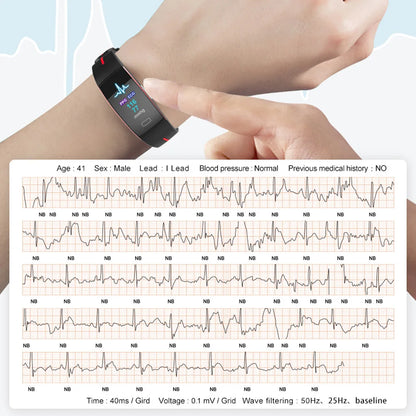 ECG+PPG Smart Bracelet Men Heart Rate Blood Pressure Oxygen Monitoring Healthy Smart Band IP67 Waterproof Sport Fitness Watch
