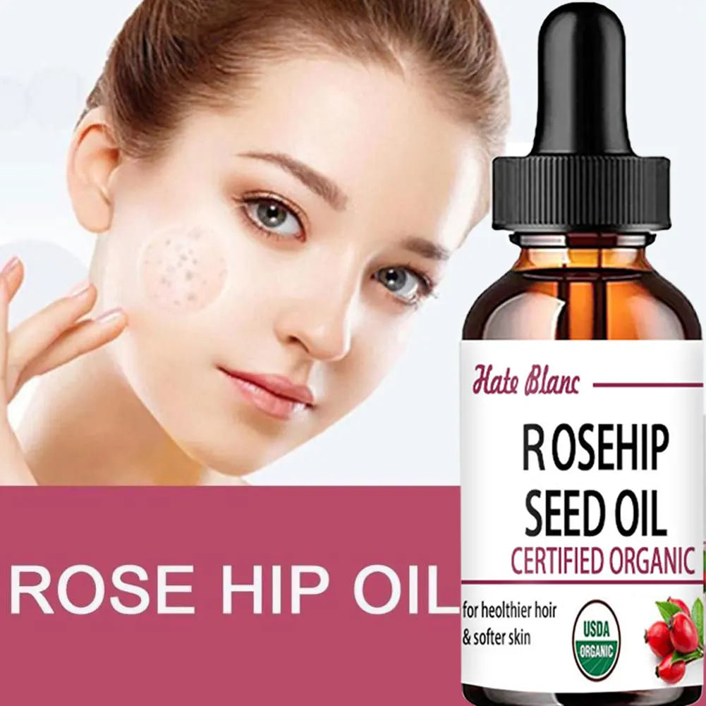 Moisturizing Rosehip Oil Oil Massage Skin Care Plant Essential Oil Moisturizing Whitening Essential Oil