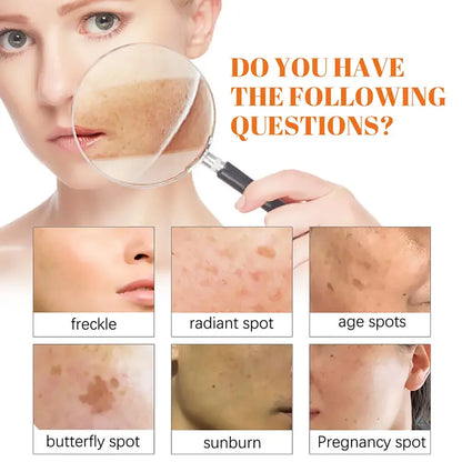 Moisturizing Rosehip Oil Oil Massage Skin Care Plant Essential Oil Moisturizing Whitening Essential Oil