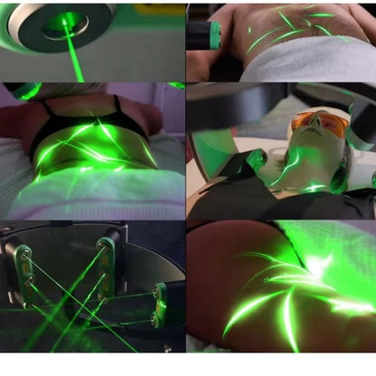 2026 Newest 10D Emerald Laser Painless 532nm green and red light Fat Weight Loss Body Shaping Slimming