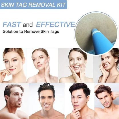 1Set Skin Tag Removal Skin Cleansing Kit For 2-4mm Skin Tag Treatment Removes In Skin Wart Mole Skin Tag Removal Tool Face Care