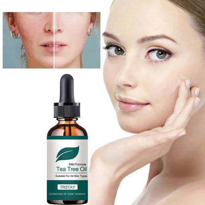 Mild formula tea tree oil is suitable for all skin types, plant essence extract