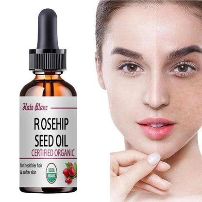 Moisturizing Rosehip Oil Oil Massage Skin Care Plant Essential Oil Moisturizing Whitening Essential Oil