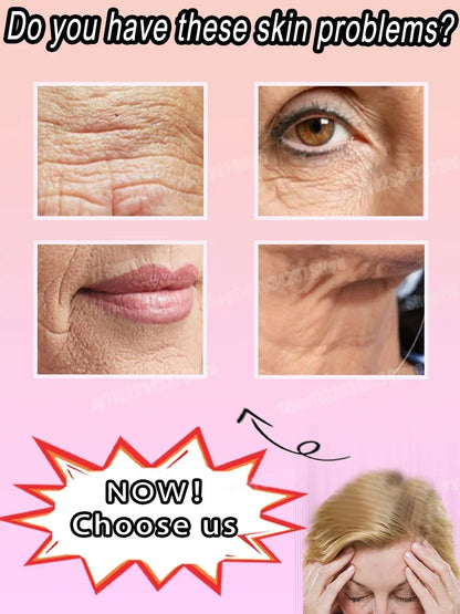 Anti-wrinkle Oil-control Serum for Anti-aging Face Neck Forehead Wrinkles Fade Fine Lines Removal Firming Skin Care Product