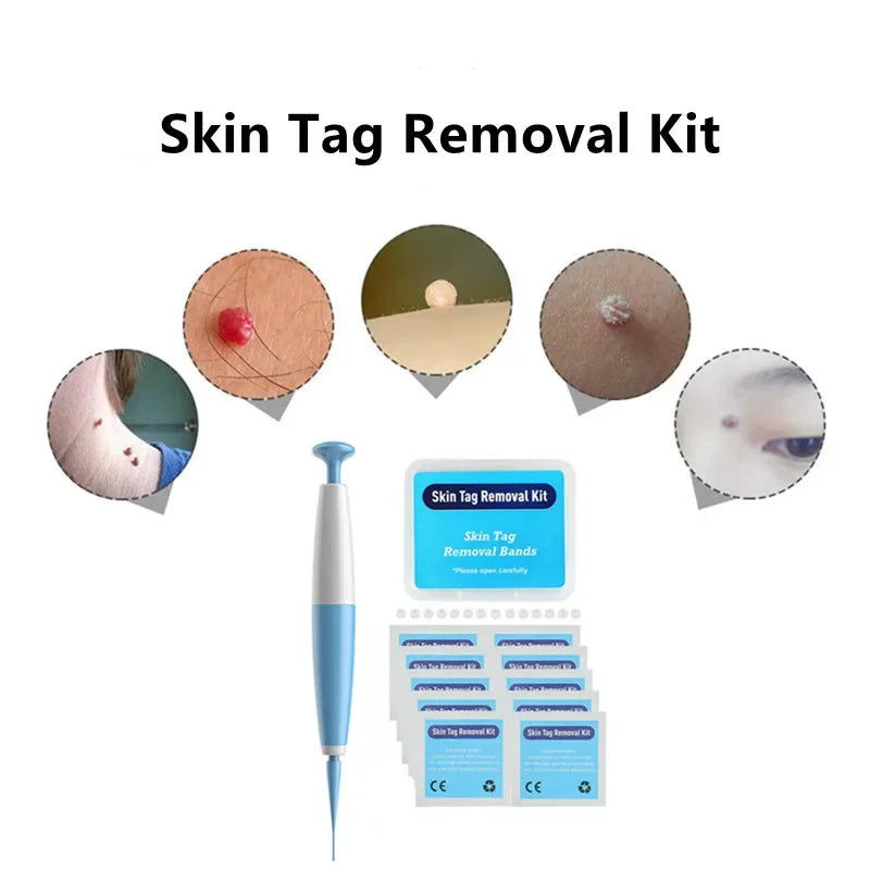 1Set Skin Tag Removal Skin Cleansing Kit For 2-4mm Skin Tag Treatment Removes In Skin Wart Mole Skin Tag Removal Tool Face Care