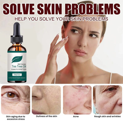 Mild formula tea tree oil is suitable for all skin types, plant essence extract