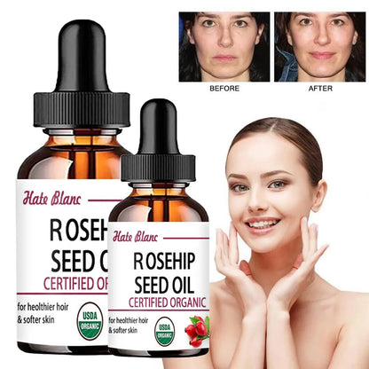 Moisturizing Rosehip Oil Oil Massage Skin Care Plant Essential Oil Moisturizing Whitening Essential Oil