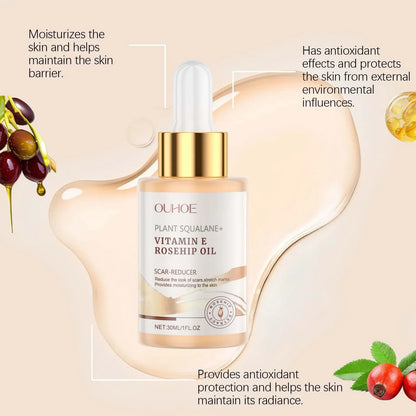 Moisturizing Squalane Rosehip Face Oil Lifting Firming Fade Fine Lines Smoothing Nourishing Skin Rejuvenation Facial Care Oil