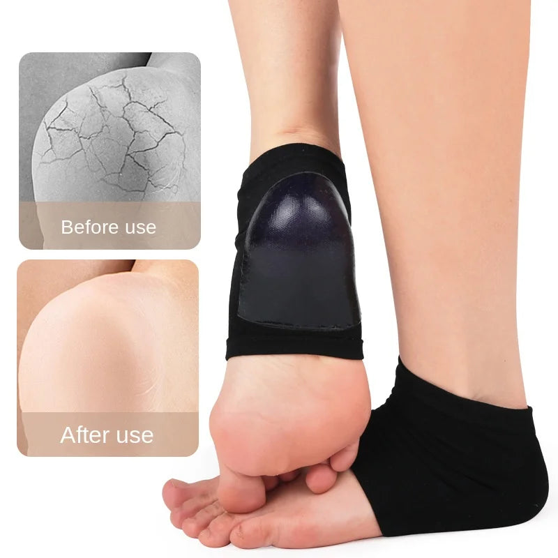 1Pair Gel Moisturizing Heel Socks Spa Sock For Foot Care Gel Heel Socks For Dry Cracked Dry Feet Skin Gel Heel Repair Socks Tool