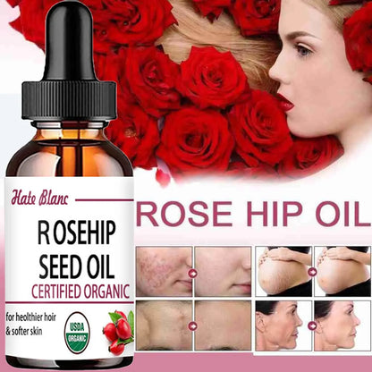 Moisturizing Rosehip Oil Oil Massage Skin Care Plant Essential Oil Moisturizing Whitening Essential Oil