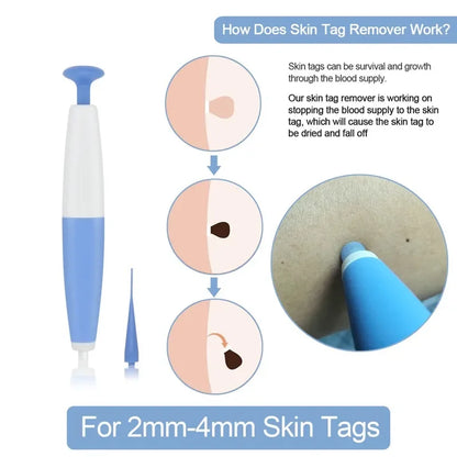 1Set Skin Tag Removal Skin Cleansing Kit For 2-4mm Skin Tag Treatment Removes In Skin Wart Mole Skin Tag Removal Tool Face Care