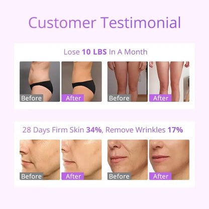 Mychway Radio Frequency Body Contouring Equipment Fat Sculpting S Shape 30k Cavitations Machine With 160MW
