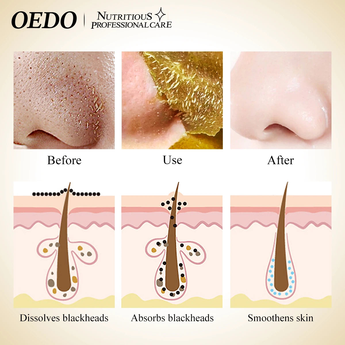 Clean Blackhead Mask Removing Blackhead Acne Skin Rejuvenation Anti-aging Whitening Moisturizing Deep Cleansing Pore Face Care