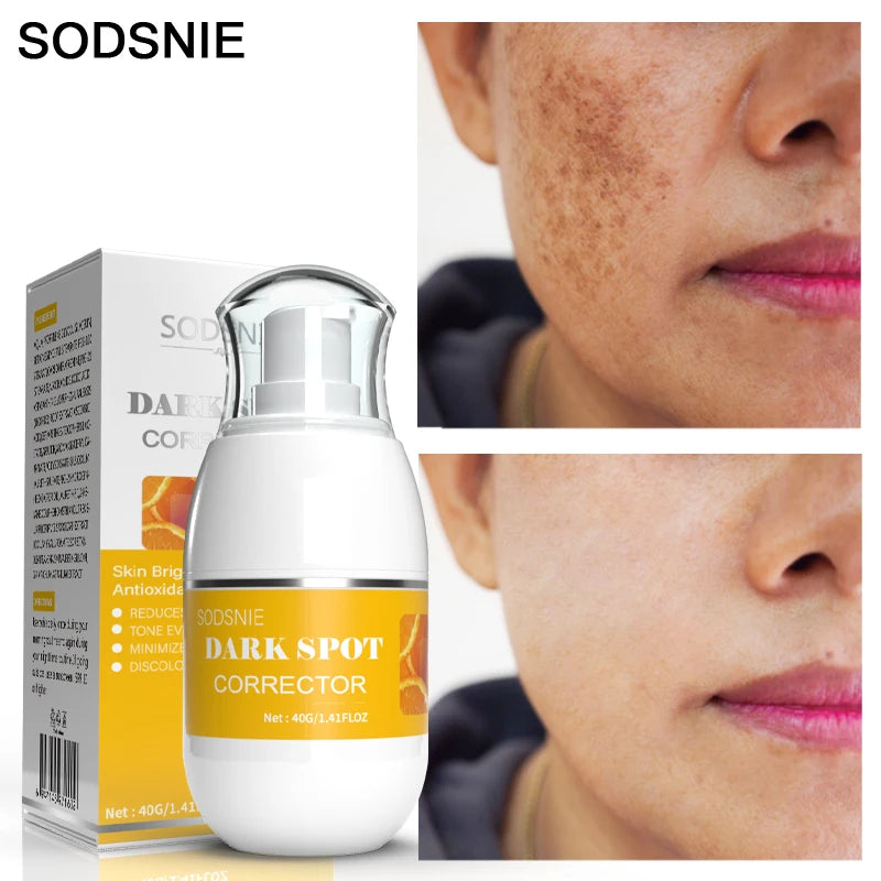 Vitamins Remove Dark Spots Lighten Sun Spots Freckles Melasma Pigmentation Whitening Cream Anti-Aging Brightening Skin Care 40g