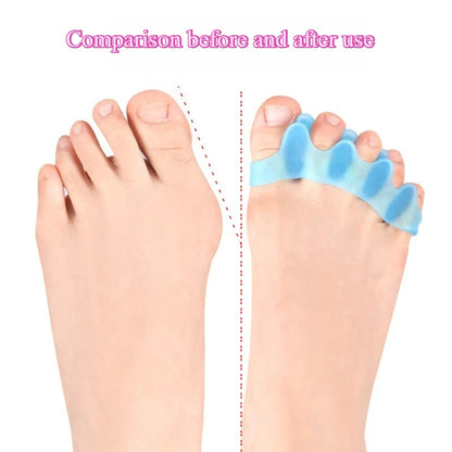 1Pair Silicone Toe Separator Hallux Valgus Corrector Bunion Orthotics Protector Pain Relief Forefoot Pad Sock Foot Care Pedicure