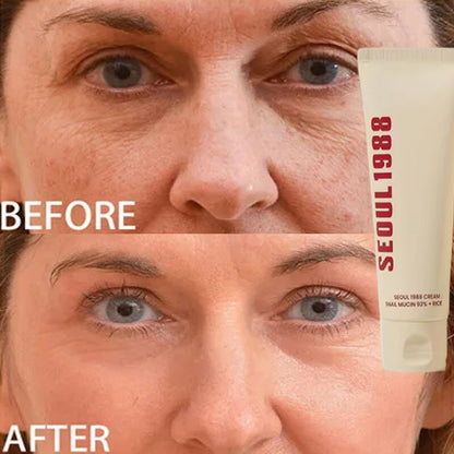 Korean 1988 Retinol Face Care Serum Black Ginseng Niacinamide 2% Acid Moisturizing Firming Cream Anti Aging Wrinkle Skin Care